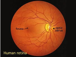 Image of a normal eye